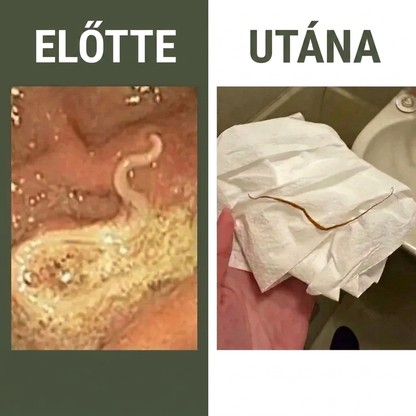 Ricinusolajos méregtelenítő csomag