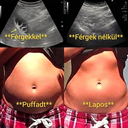 Ricinusolajos méregtelenítő csomag
